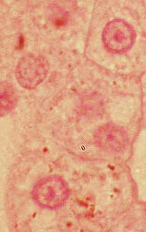 upper extended